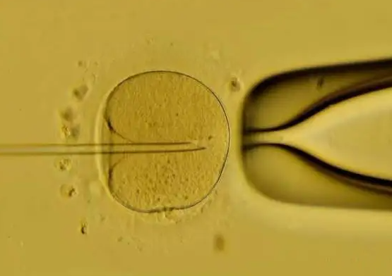计算试管婴儿代孕的方式公开，3个锦囊帮助防止胎停