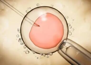 三代试管和二代试管有什么区别移植时间和胚胎筛选上大有不同