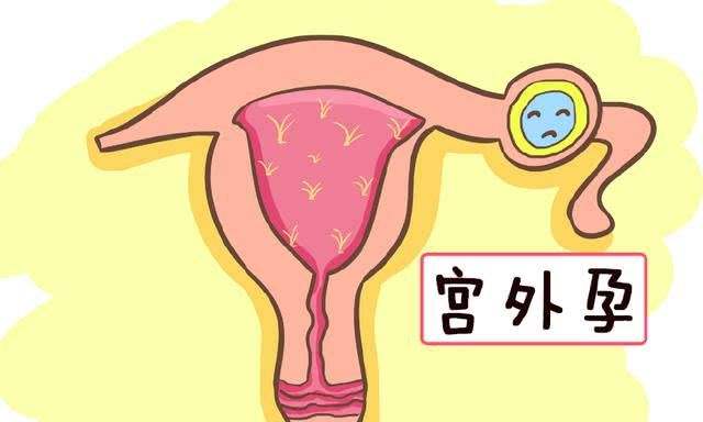 日本做试管婴儿多少钱